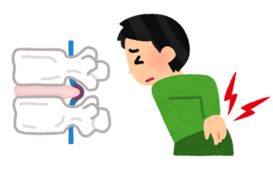 腰椎椎間板ヘルニアとは？のアイキャッチ画像